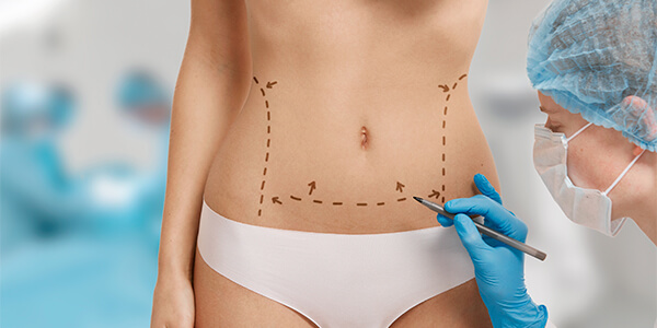 abdominoplastia em campinas e regiao cirurgia do abdomen