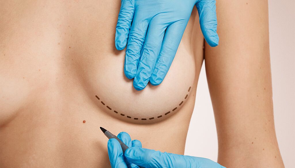 Cirurgia Estetica tipos mais procurados mamoplastia seios